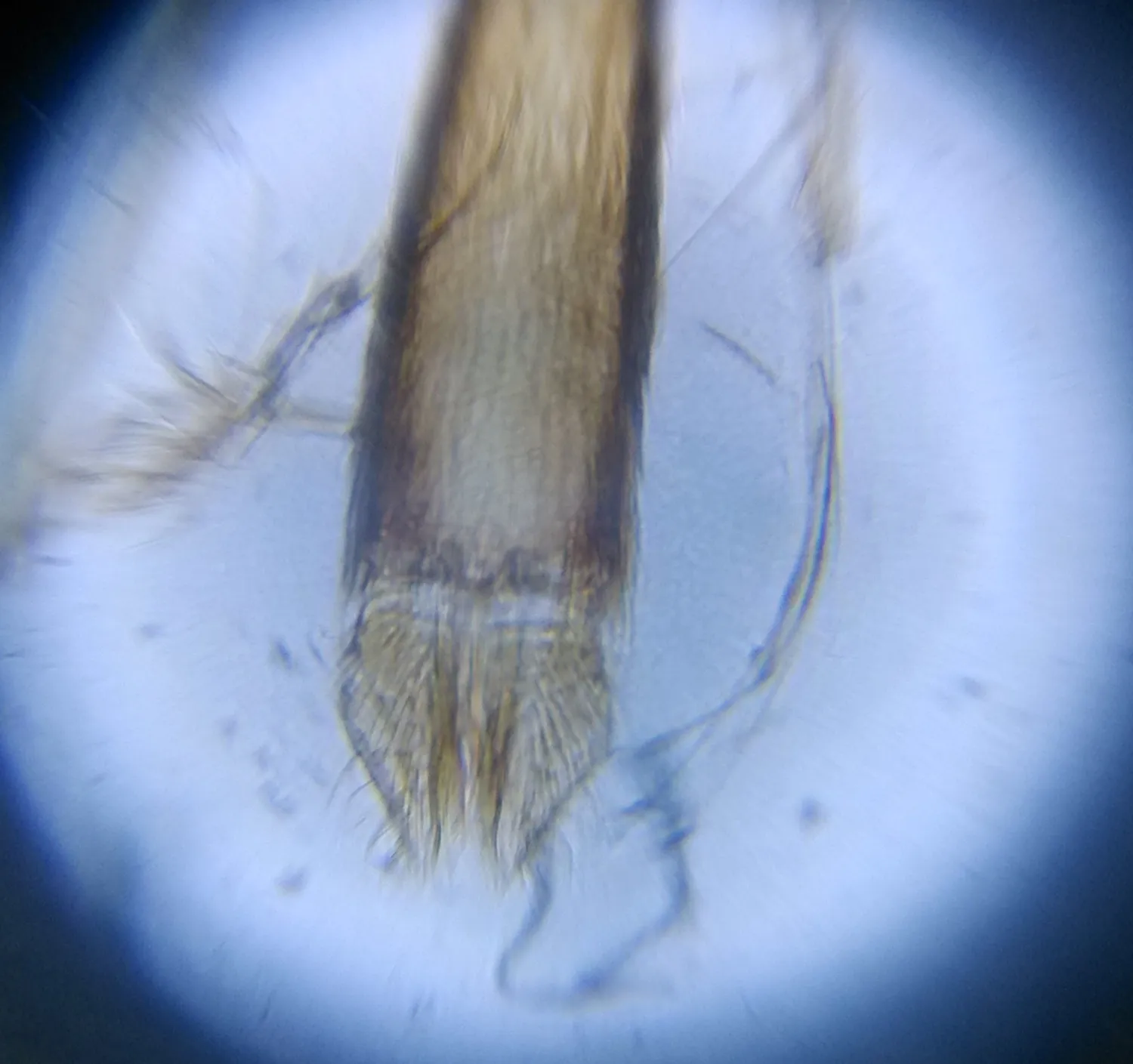 Dard de moustique vu au microscope x150